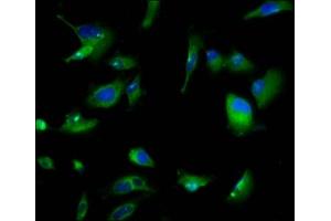 Immunofluorescence staining of U251 cells with ABIN7164465 at 1:166, counter-stained with DAPI. (GPR158 抗体  (AA 882-1003))