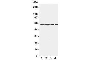 Western Blotting (WB) image for anti-Lecithin-Cholesterol Acyltransferase (LCAT) (AA 300-313) antibody (ABIN3031596)