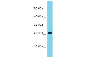 Western Blotting (WB) image for anti-ATP Synthase, H+ Transporting, Mitochondrial F0 Complex, Subunit S (Factor B) (ATP5S) (N-Term) antibody (ABIN2791079)