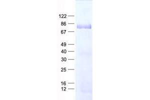 Western Blotting (WB) image for phosphodiesterase 1C, Calmodulin-Dependent 70kDa (PDE1C) protein (His tag) (ABIN2728485)