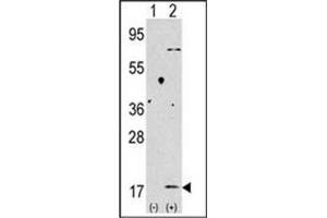 Western Blotting (WB) image for anti-Microtubule-Associated Protein 1 Light Chain 3 beta (MAP1LC3B) (AA 88-118), (C-Term) antibody (ABIN1449627)