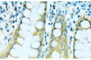 Immunohistochemistry of paraffin-embedded Human colon using CYP2B6 Polyclonal Antibody at dilution of 1:100 (40x lens). (CYP2B6 抗体)