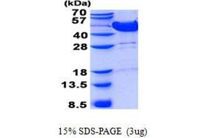 Image no. 1 for Mevalonate Kinase (MVK) protein (His tag) (ABIN1098525) (MVK Protein (His tag))
