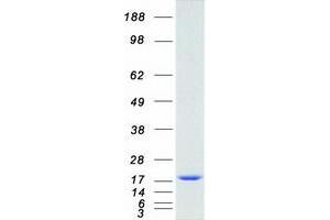 Western Blotting (WB) image for Cytochrome b5 (CYTB5) (Transcript Variant 1) protein (Myc-DYKDDDDK Tag) (ABIN2712809)
