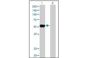 Western Blotting (WB) image for anti-NIMA (Never in Mitosis Gene A)-Related Kinase 2 (NEK2) (AA 331-445) antibody (ABIN781938) (NEK2 抗体  (AA 331-445))