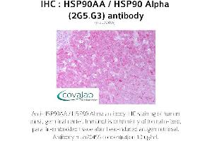 Image no. 1 for anti-Heat Shock Protein 90kDa alpha (Cytosolic), Class A Member 1 (HSP90AA1) antibody (ABIN1723331)