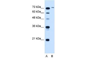 SLCO6A1 antibody used at 5 ug/ml to detect target protein. (SLCO6A1 抗体  (N-Term))