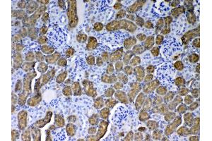 IHC analysis of PAH using anti-PAH antibody . (Phenylalanine Hydroxylase 抗体  (AA 71-208))