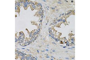 Immunohistochemistry of paraffin-embedded human prostate using EIF3H Antibody. (EIF3H 抗体)