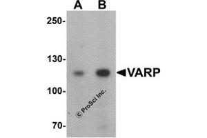 Western Blotting (WB) image for anti-Ankyrin Repeat Domain 27 (VPS9 Domain) (ANKRD27) (N-Term) antibody (ABIN1031656) (ANKRD27 抗体  (N-Term))