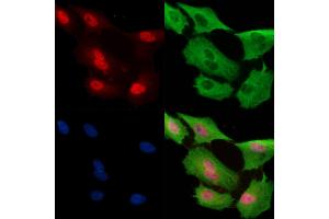 Phospho-Nanog (Thr280) Antibody staining A549 cells(H2O2 treatment) by IF/ICC. (Nanog 抗体  (pThr280))