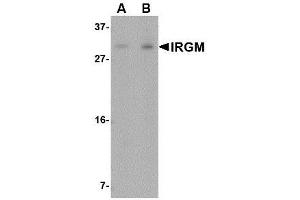 Image no. 1 for anti-Immunity-Related GTPase Family, M (IRGM) (N-Term) antibody (ABIN1494356) (IRGM 抗体  (N-Term))