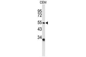 Western blot analysis of ACCN2 Antibody (C-term) in CEM cell line lysates (35 µg/lane). (ASIC1 抗体  (C-Term))