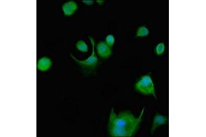 Immunofluorescent analysis of MCF-7 cells using ABIN7174064 at dilution of 1:100 and Alexa Fluor 488-congugated AffiniPure Goat Anti-Rabbit IgG(H+L) (SRMS 抗体  (AA 19-155))