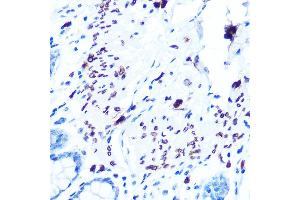Immunohistochemistry of paraffin-embedded human colon using Emerin/EMD Rabbit mAb (ABIN7266933) at dilution of 1:100 (40x lens). (Emerin 抗体)