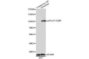 Western blot analysis of extracts of 293T cells, using Phospho-FoxO1-S256 antibody (ABIN5969947) at 1/1000 dilution. (FOXO1 抗体  (pSer256))