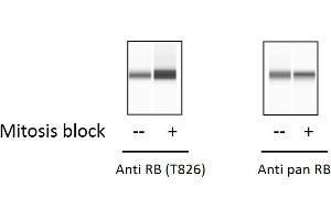 HT29 cells were treated with Thymidine-Nocodazole Block. (Retinoblastoma 1 ELISA 试剂盒)