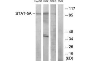 Western Blotting (WB) image for anti-Signal Transducer and Activator of Transcription 5A (STAT5A) (AA 666-715) antibody (ABIN2889069) (STAT5A 抗体  (AA 666-715))