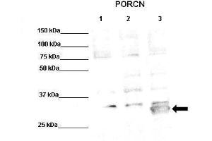 WB Suggested Anti-PORCN Antibody  Positive Control: Lane1: 50ug PORCN-KO HT1080 (microsomes), Lane2: 50ug HT1080 (microsomes), Lane3: 50ug PORCN transfected HT1080 (microsomes)  Primary Antibody Dilution :  1:500 Secondary Antibody :  Anti-rabbit-HRP  Secondry Antibody Dilution :  1:10,000 Submitted by: Anonymous (PORCN 抗体  (Middle Region))