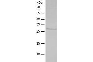 Western Blotting (WB) image for Zinc Finger, FYVE Domain Containing 9 (ZFYVE9) (AA 1013-1280) protein (His tag) (ABIN7284734) (ZFYVE9 Protein (AA 1013-1280) (His tag))