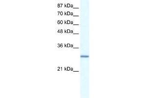 Human Daudi; WB Suggested Anti-GTF2E2 Antibody Titration: 0. (GTF2E2 抗体  (N-Term))