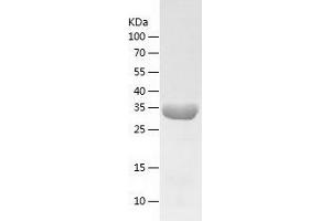 PRPS2 Protein (AA 2-318) (His tag)