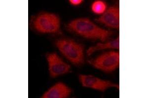 Immunofluorescenitrocellulosee of human HeLa cells stained with Hoechst 3342 (Blue) for nucleus staining and monoclonal anti-human LDHA antibody (1:500) with Texas Red (Red).