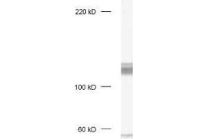 dilution: 1 : 1000, sample: crude synaptosomal fraction of rat brain (P2) (DLG1 抗体)