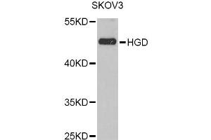 Western blot analysis of extracts of SKOV3 cells, using HGD Antibody (ABIN2563034) at 1:1000 dilution.