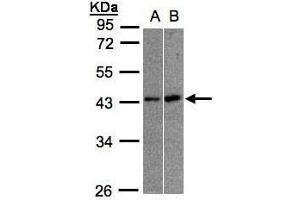 WB Image Sample(30 ug whole cell lysate) A:A431, B:Raji , 10% SDS PAGE antibody diluted at 1:1000 (MBNL3 抗体)