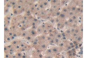 Immunohistochemistry (IHC) image for anti-SP100 Nuclear Antigen (SP100) (AA 610-802) antibody (ABIN7442741)