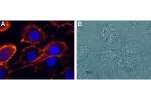 Immunocytochemistry (ICC) image for anti-Glutamate Receptor, Ionotropic, N-Methyl D-Aspartate 2a (GRIN2A) (AA 41-53), (Extracellular) antibody (ABIN7043228)