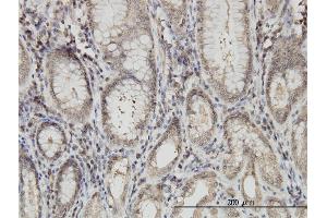 Immunoperoxidase of monoclonal antibody to ARVCF on formalin-fixed paraffin-embedded human stomach. (ARVCF 抗体  (AA 863-962))