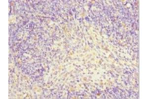 Immunohistochemistry of paraffin-embedded human thymus tissue using ABIN7143883 at dilution of 1:100 (TFCP2 抗体  (AA 1-280))