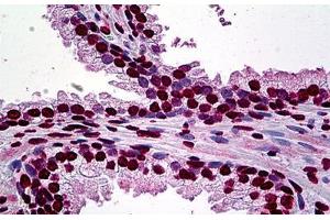 Human Prostate: Formalin-Fixed, Paraffin-Embedded (FFPE) (AFT1 抗体  (AA 1-272))