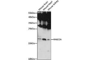 Western blot analysis of extracts of various cell lines, using RA antibody (ABIN7269801) at 1:1000 dilution. (RAB22A 抗体  (AA 1-100))