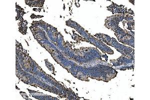 IHC analysis of Astrin/Deepest/SPAG5 using anti-Astrin/Deepest/SPAG5 antibody (ABIN7602399). (SPAG5 抗体  (AA 738-1193))
