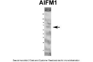 WB Suggested Anti-AIFM1 Antibody Titration: 1 ug/mlPositive Control: Rat tissue (AIF 抗体  (Middle Region))