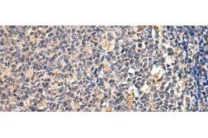 Immunohistochemistry of paraffin-embedded Human tonsil tissue using ENTPD1 Polyclonal Antibody at dilution of 1:60(x200) (CD39 抗体)