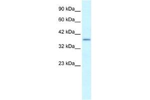 WB Suggested Anti-SOX18 Antibody Titration:  0.