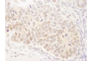 anti-Mastermind-Like 3 (MAML3) (C-Term) antibody