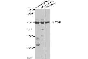 Western blot analysis of extracts of various cell lines, using CLPTM1 Antibody. (CLPTM1 抗体)