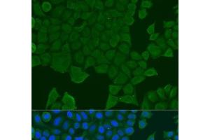 Immunofluorescence analysis of U2OS cells using REEP1 Polyclonal Antibody at dilution of 1:100. (Receptor Accessory Protein 1 抗体)