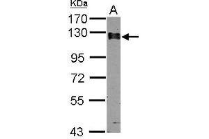 Western Blotting (WB) image for anti-Calpastatin (CAST) (AA 275-700) antibody (ABIN1497106) (Calpastatin 抗体  (AA 275-700))