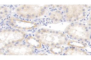 Detection of TNFb in Human Kidney Tissue using Monoclonal Antibody to Tumor Necrosis Factor Beta (TNFb) (LTA 抗体  (AA 36-205))