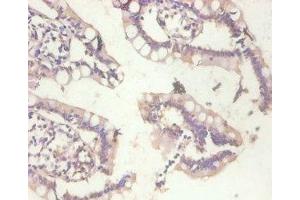 Immunohistochemistry of paraffin-embedded human small intestine tissue using ABIN7159509 at dilution of 1:100