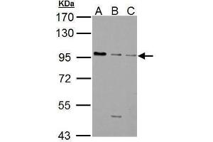 WB Image GABA B Receptor 1 antibody [N2C1], Internal detects GABBR1 protein by Western blot analysis.