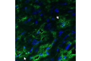 Immunohistochemical staining of snap frozen mouse heart, left and Right ventricle sections with Anti-KV1.