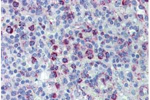 Human Spleen (formalin-fixed, paraffin-embedded) stained with HSPD1 antibody ABIN462365 followed by biotinylated anti-goat IgG secondary antibody ABIN481715, alkaline phosphatase-streptavidin and chromogen.