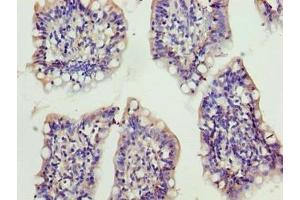 Immunohistochemistry of paraffin-embedded human small intestine tissue using ABIN7175892 at dilution of 1:100 (XRRA1 抗体  (AA 101-400))